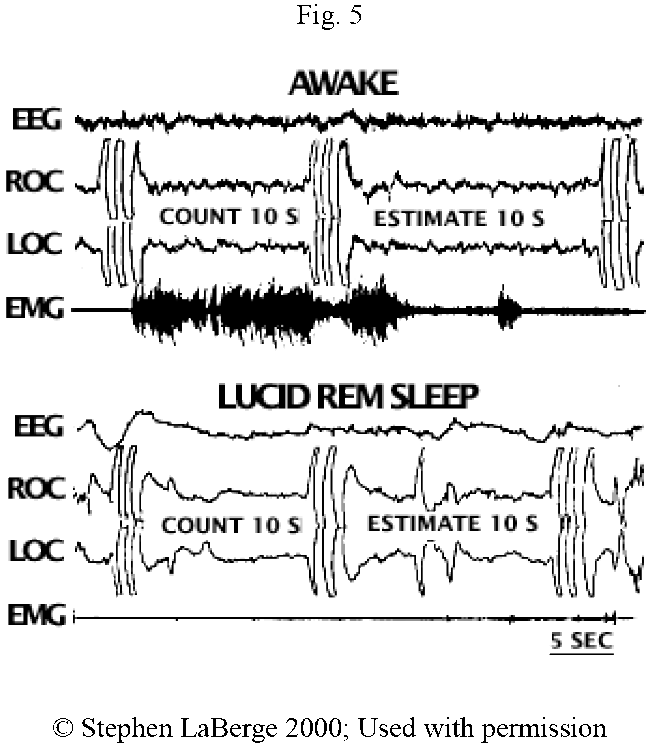 https://iep.utm.edu/wp-content/media/Fig-5.gif